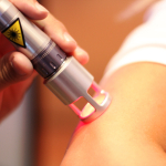 Elbow-Treatment-2(72dpi)
